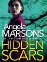 Hidden Scars audiobook